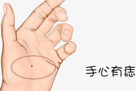 手相分析：一个人的手掌有痣代表的含义是什么，性格心思缜密