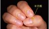 五星算命_指甲半月痕透露出的健康秘密