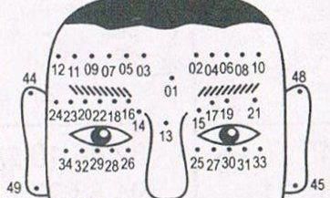 痣的位置与命运图 脸上的痣图解