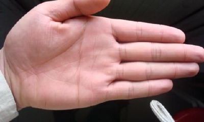 老中医手诊:看手掌心色调,身心健康安全隐患早知