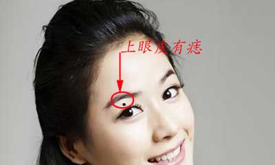 上眼皮有痣好坏