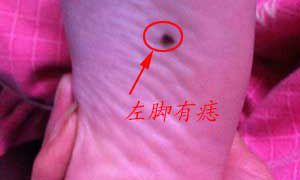 左脚脚底有痣好不好?