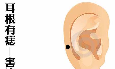 耳根有痣