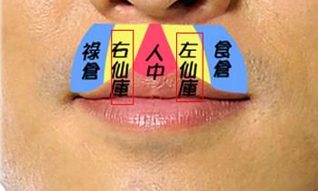 人中有痣代表什么,人中有痣好么