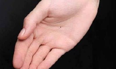 掌心有痣代表什么,掌心有痣人的性格与命运