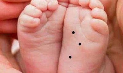 脚底心有痣代表着什么,脚底心有痣详解