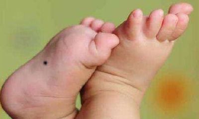 脚心有痣代表什么,脚心有痣图解