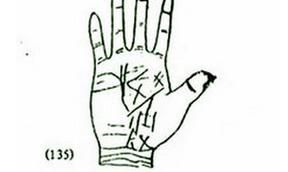 一生多灾的掌纹