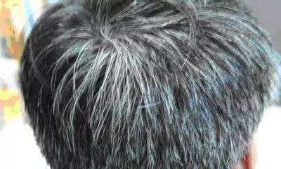 梦到自己头顶有很多白发