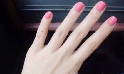 女人小指有痣代表什么