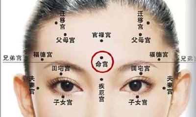 命宫有痣的人命好吗