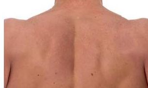 五处胎记影响你的运势