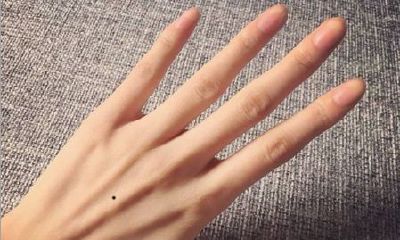 左手手背有痣的男生命运好吗