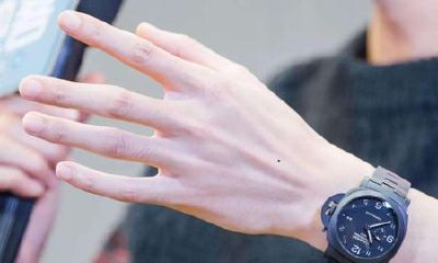 男人手背上长痣图解解析