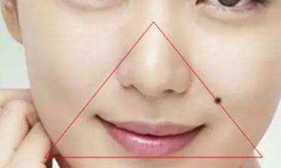 法令纹有痣的痣相解析