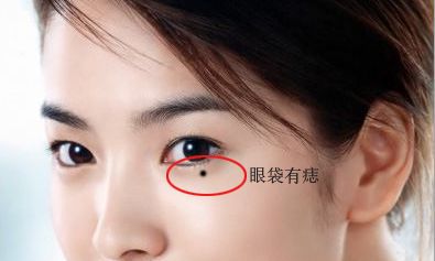 女人眼袋有痣代表什么