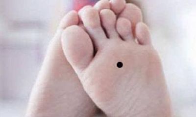 脚底有痣的女人贵气吗