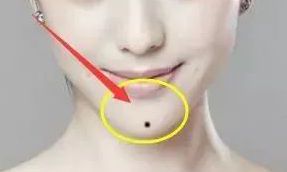 女人下颚长痣代表什么