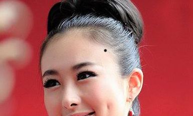 女人迁移宫有痣好吗