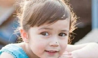 富贵的痣相有哪些 哪些痣代表着你是富贵命