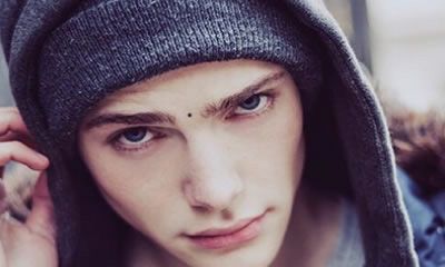 男人面部痣好不好