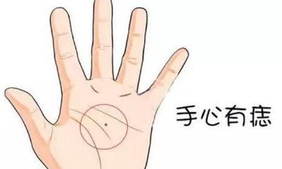 手心长痣意味着什么