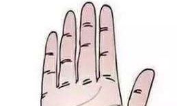 手掌生命线长痣