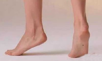 脚底中心长痣代表什么