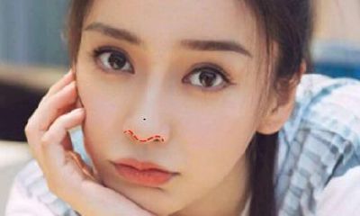 鼻子的痣长在这几个位置才会破财