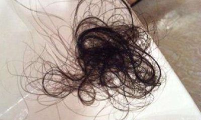 梦到掉一大把秀发