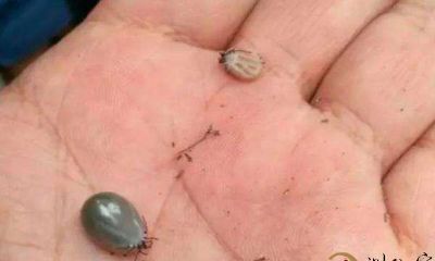 梦到人体里有许多小虫子