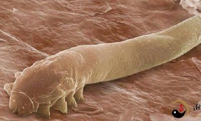 梦到脸上有小虫子