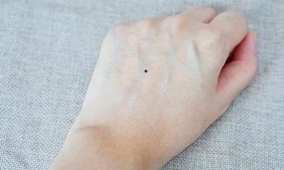 手背长痣好不好 手背痣相的含义