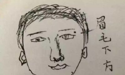 人身上的四处大恶之痣,让人霉运不断,婚姻不稳,一定不能留