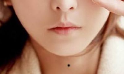 珍惜脖子上有三颗痣:脖子前后正中有痣各代表什么