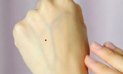 左手手背上长痣图解