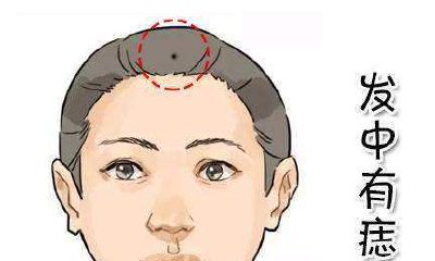 面部痣的位置与命运,看看你有没有富贵痣
