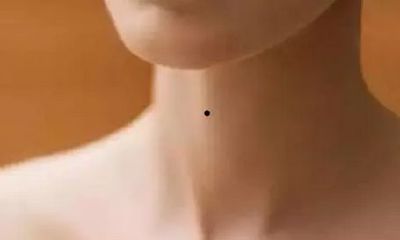 痣相影响运势-身体上中最重要的几颗痣