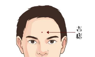 身上这五处有痣是富贵痣