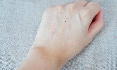 手背上长痣什么意思,手背长痣的人财运更好吗