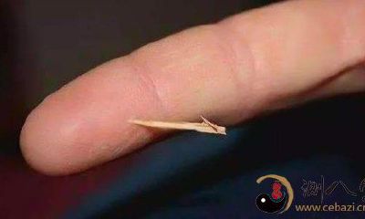 梦到手指头里扎刺