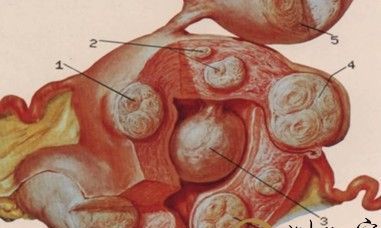 梦到子宫异常出血