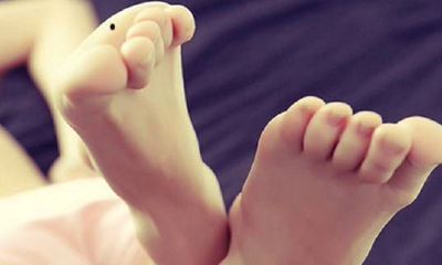 脚底的痣一定要去掉吗