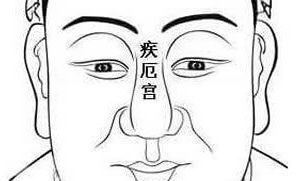 疾厄宫有痣代表什么