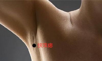 左侧肋下有痣是什么意思