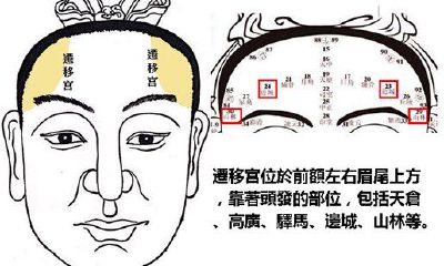 迁移宫长痣代表什么