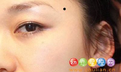 什么是“是非痣”,“是非痣”全面解析