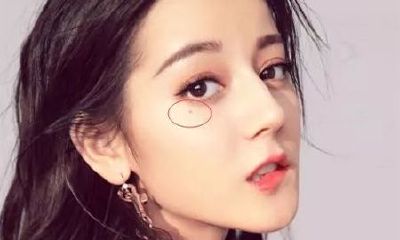 脸上有痣的女演员图片