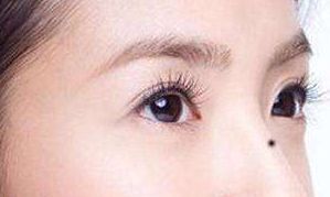 鼻子上面有痣代表什么