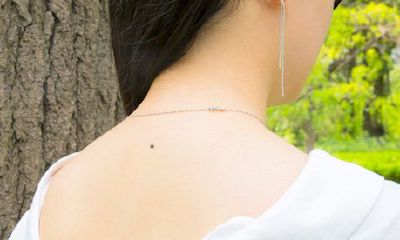 女人背后有痣代表什么